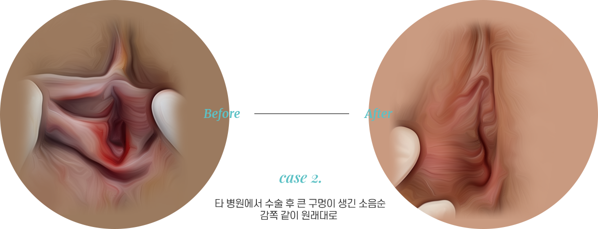 전후사진2