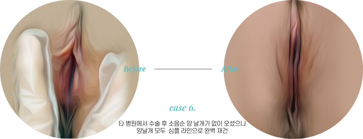 전후사진6